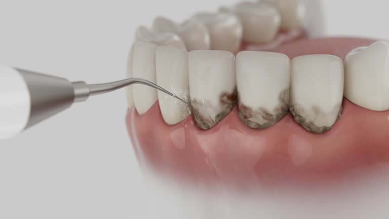 Reliable Dental contractor in Kosciusko County County, IN by Dentist Open Now